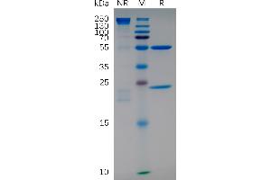 Anti-I (natalizumab biosimilar) mAb on SDS-PAGE under non-reducing (NR) and reducing (R) conditions. (Recombinant ITGA4 (Natalizumab Biosimilar) 抗体)