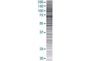 Western Blotting (WB) image for RFX5 293T Cell Transient Overexpression Lysate(Denatured) (ABIN1333304)