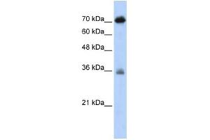 WB Suggested Anti-NKRF Antibody Titration:  0. (NKRF 抗体  (N-Term))