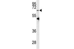 Western blot analysis of PRMT5 antibody and HL-60 lysate (PRMT5 抗体  (AA 473-499))