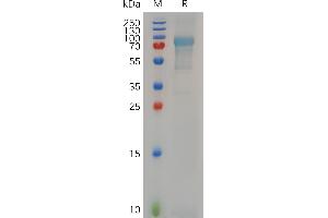 Human MBP, hFc Tag on SDS-PAGE under reducing condition. (MBP Protein (Fc Tag))