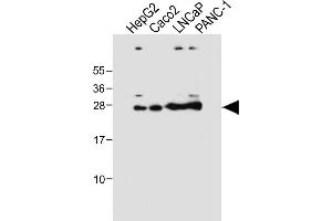 All lanes : Anti-GSTA1 Antibody at 1:4000 dilution Lane 1: HepG2 whole cell lysate Lane 2: Caco2 whole cell lysate Lane 3: LNCaP whole cell lysate Lane 4: NC-1 whole cell lysate Lysates/proteins at 20 μg per lane. (GSTA1 抗体)