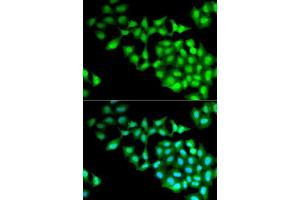 Immunofluorescence analysis of MCF7 cells using RNGTT antibody. (RNGTT 抗体  (AA 1-260))