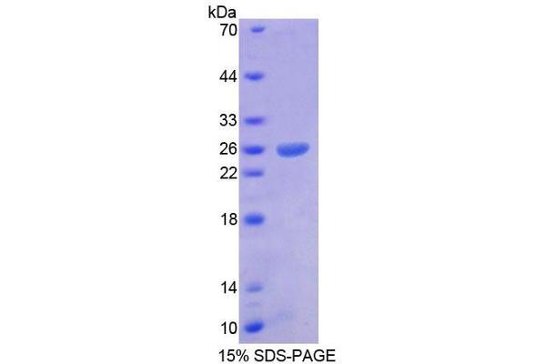 Arx Protein (AA 25-246) (T7 tag,His tag)