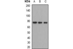 Western blot analysis of ZBTB48 expression in HEK293T (A), mouse liver (B), mouse testis (C) whole cell lysates. (ZBTB48 抗体)