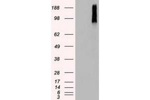 HEK293T cells were transfected with the pCMV6-ENTRY control (Left lane) or pCMV6-ENTRY BRAF (Right lane) cDNA for 48 hrs and lysed. (BRAF 抗体)