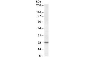 Western blot testing of NIH3T3 lysate with SAR1 antibody at 0. (SAR1A 抗体)