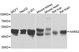 Western blot analysis of extracts of various cells, using HARS2 antibody. (HARS2 抗体)