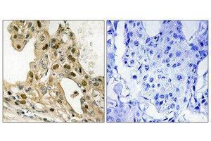 Immunohistochemistry (IHC) image for anti-Tumor Protein P53 (TP53) (pThr387) antibody (ABIN1847562) (p53 抗体  (pThr387))