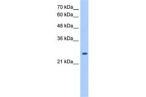 WB Suggested Anti-PRDX6 Antibody Titration:  1. (Peroxiredoxin 6 抗体  (Middle Region))