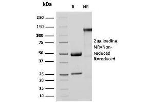 SDS-PAGE (SDS) image for anti-Methylthioadenosine phosphorylase (MTAP) (AA 97-196) antibody (ABIN6940089)