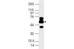 Image no. 1 for anti-ATG16 Autophagy Related 16-Like 1 (ATG16L1) (AA 35-260) antibody (ABIN5027030) (ATG16L1 抗体  (AA 35-260))