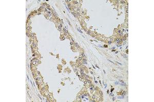 Immunohistochemistry of paraffin-embedded human prostate using KCNJ3 antibody (ABIN6003556) at dilution of 1/100 (40x lens). (KCNJ3 抗体)