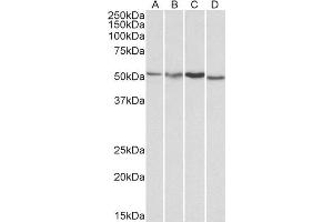 ABIN2561021 (1µg/ml) staining of HepG2 (A), Jurkat (B), Mouse Brain (C) and Rat Brain (D) lysates (35µg protein in RIPA buffer). (AKT3 抗体  (Internal Region))