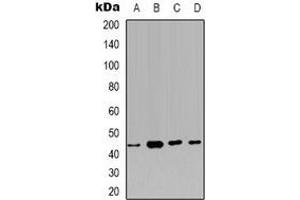 Western blot analysis of Carbonic Anhydrase 12 expression in HEK293T (A), PC3 (B), MCF7 (C), NIH3T3 (D) whole cell lysates. (CA12 抗体)