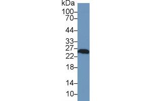 Western Blot; Sample: Human A549 cell lysate; Primary Ab: 1µg/ml Rabbit Anti-Rat UCHL1 Antibody Second Ab: 0. (UCHL1 抗体  (AA 2-223))