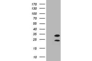 Image no. 3 for anti-Membrane-Spanning 4-Domains, Subfamily A, Member 1 (MS4A1) antibody (ABIN1497206) (CD20 抗体)