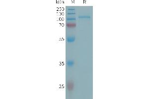 Human E Protein, His Tag on SDS-PAGE under reducing condition. (ENPP2 Protein (AA 49-863) (His tag))