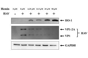 Changes in HO-1 and HAV proteins according to hemin concentration. (HAV VP1 抗体)