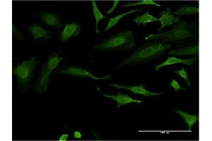 Immunofluorescence of monoclonal antibody to FOXO1 on HeLa cell. (FOXO1 抗体  (AA 452-555))