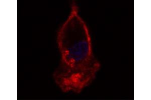 Hooded seal bronchoalveolar lavage cells were stained with Mouse Anti-Human CD14-UNLB:. (CD14 抗体)