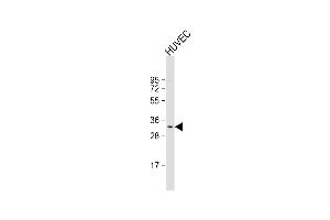 Western Blot at 1:1000 dilution + HUVEC whole cell lysate Lysates/proteins at 20 ug per lane. (CNOT8 抗体  (N-Term))