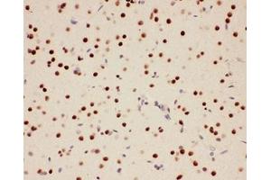 IHC-P: PIAS1 antibody testing of rat brain tissue (PIAS1 抗体  (AA 636-651))