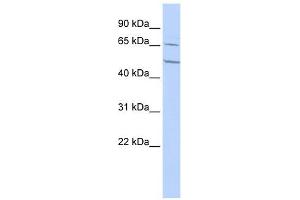 CHRNA4 antibody used at 1 ug/ml to detect target protein. (CHRNA4 抗体  (N-Term))