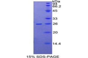 SDS-PAGE analysis of Human DDAH1 Protein. (DDAH1 蛋白)