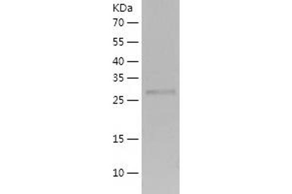 HAAO Protein (AA 1-286) (His tag)