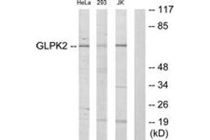 Western Blotting (WB) image for anti-Glycerol Kinase 2 (GK2) (AA 281-330) antibody (ABIN2889591) (GK2 抗体  (AA 281-330))