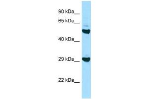 Western Blotting (WB) image for anti-Major Histocompatibility Complex, Class II, DO beta (HLA-DOB) (N-Term) antibody (ABIN2788876) (HLA-DOB 抗体  (N-Term))