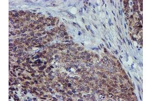 Immunohistochemistry (IHC) image for anti-Arachidonate 15-Lipoxygenase (ALOX15) antibody (ABIN1496358) (ALOX15 抗体)