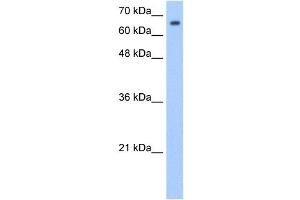 SYVN1 antibody used at 1. (SYVN1 抗体  (Middle Region))