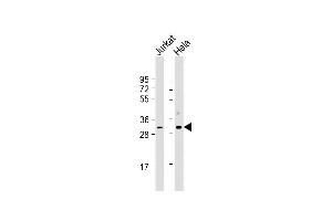 All lanes : Anti-CDK1 Antibody at 1:500-1:1000 dilution Lane 1: Jurkat whole cell lysate Lane 2: Hela whole cell lysate Lysates/proteins at 20 μg per lane. (CDK1 抗体  (AA 1-297))