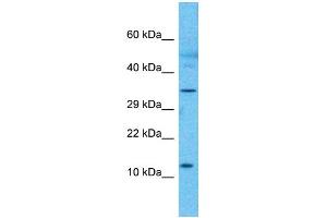 Western Blotting (WB) image for anti-RP3-473B4.1 (N-Term) antibody (ABIN2785035) (RP3-473B4.1 (N-Term) 抗体)