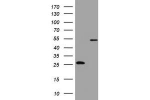 Image no. 4 for anti-3-Oxoacyl-ACP Synthase, Mitochondrial (OXSM) (AA 78-343) antibody (ABIN1491674) (OXSM 抗体  (AA 78-343))