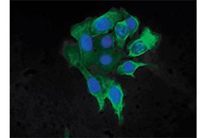 Human pancreatic carcinoma cell line MIA PaCa-2 was stained with Mouse Anti-Cytokeratin 8-FITC followed by DAPI. (KRT8 抗体  (C-Term) (FITC))