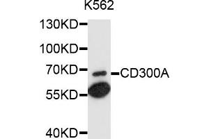 Western blot analysis of extracts of K-562 cells, using CD300A antibody (ABIN6003714) at 1/1000 dilution. (CD300a 抗体)