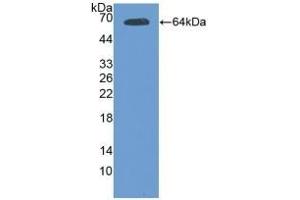 Detection of Recombinant Tie2, Mouse using Polyclonal Antibody to TEK Tyrosine Kinase, Endothelial (Tie2) (TEK 抗体)