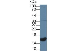 Western Blot; Sample: Human Lung lysate; Primary Ab: 1µg/ml Rabbit Anti-Human CNP Antibody Second Ab: 0. (NPPC 抗体  (AA 33-125))