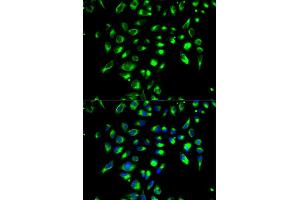 Immunofluorescence analysis of MCF-7 cells using CD86 antibody (ABIN5970542). (CD86 抗体)