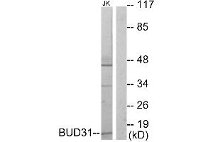 Western blot analysis of extracts from Jurkat cells, using BUD31 antibody. (BUD31 抗体  (Internal Region))