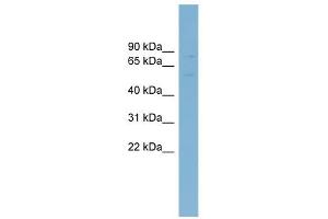 ABCG5 antibody used at 1 ug/ml to detect target protein. (ABCG5 抗体)