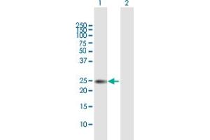 Western Blot analysis of TIMP1 expression in transfected 293T cell line by TIMP1 MaxPab polyclonal antibody. (TIMP1 抗体  (AA 1-207))