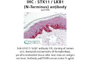 Image no. 1 for anti-serine/threonine Kinase 11 (STK11) antibody (ABIN1739721) (LKB1 抗体)