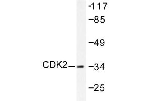 Image no. 1 for anti-Cyclin-Dependent Kinase 2 (CDK2) antibody (ABIN265344) (CDK2 抗体)