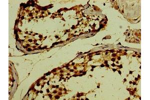 Immunohistochemistry of paraffin-embedded human testis tissue using ABIN7163056 at dilution of 1:100 (PHF6 抗体  (AA 2-312))