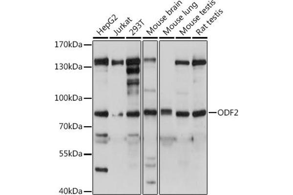 ODF2 抗体  (AA 630-829)