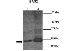 Sample Type: Lane 1:241 µg mouse mesenchymal stem cell lysate Primary Antibody Dilution: 1:0000Secondary Antibody: Anti-rabbit-HRP Secondary Antibody Dilution: 1:00,000 Color/Signal Descriptions: RUNX2  Gene Name: Anonymous Submitted by: (RUNX2 抗体  (N-Term))